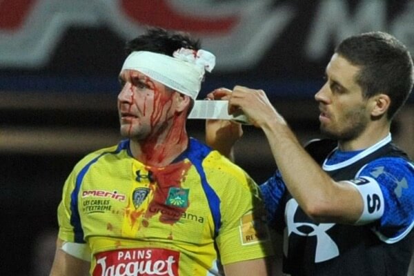 worst rugby injuries